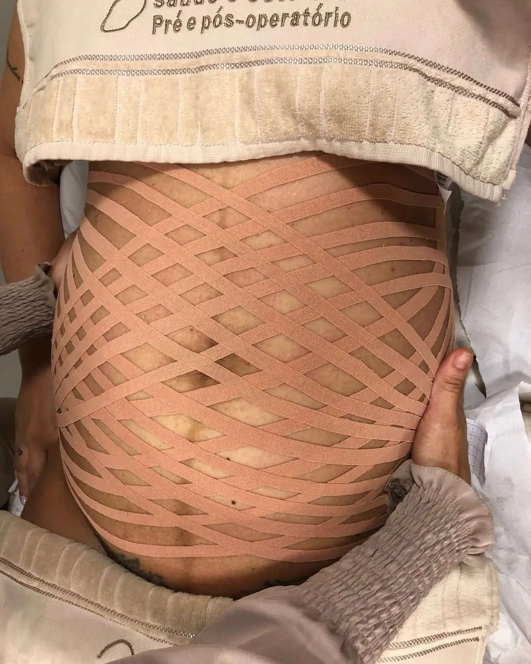 Taping para gestantes
